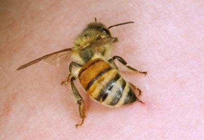Апитерапия - лечение пчелами