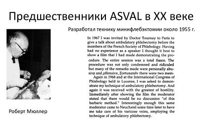 История методики минифлебэктомии
