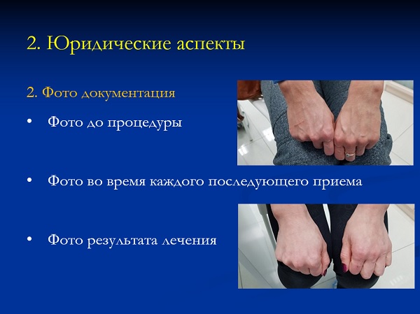 Фотодокументация – важный юридический аспект