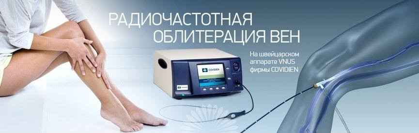 Эндовенозная радиочастотная абляция (РЧА) вен нижних конечностей