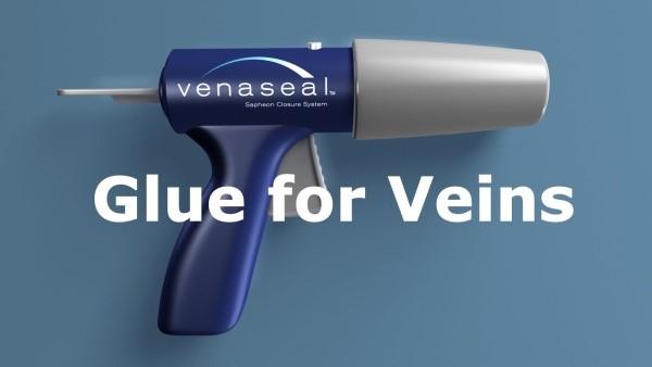 Клеевая облитерация варикозных вен методом "Venaseal"