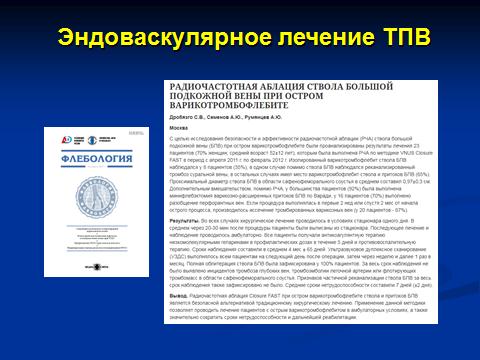 В России в 2012 году на Съезде Ассоциации флебологов России нами был представлен доклад об использовании радиочастотной абляции у 23 пациентов с острым тромбофлебитом.